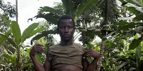 El joven que cayó de una palmera y sobrevivió